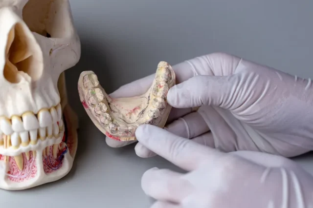Oral surgery tori removal